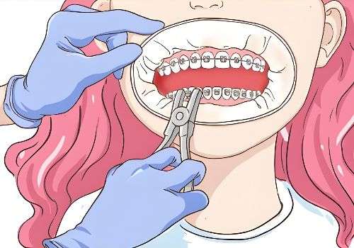 上海正畸医生倪勇信息分析！技术口碑点评、2026年价格明细公布插图1