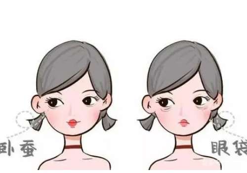 南京王鸣医生眼袋手术技术如何?价格及患者口碑全解析插图1