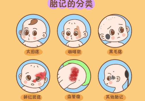 上海九院陈辉和罗旭松谁手术做胎记好？2026技术比拼、各有千秋！插图