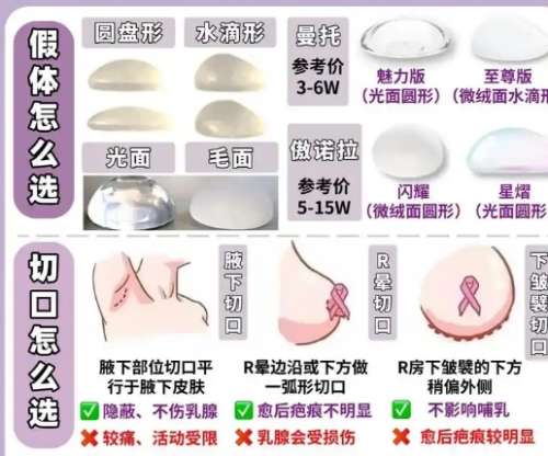 陈宝贵医生怎么样？胸部整形医生推荐 | 维密插图3