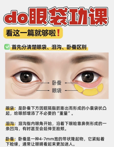 杭州去眼袋哪个医生好？内行人教你精准筛选插图