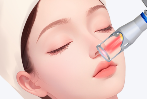 王晓健医生做人中缩短怎么样？适合人群、手术细节和风险点一文说清插图