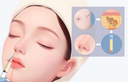 深圳北大医院何君君怎么样？擅长项目、客户真实口碑附上！插图3