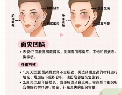 陈文可医生怎么样?东莞台心医院脂肪整形插图3 陈文可医生怎么样?东莞台心医院脂肪整形插图3