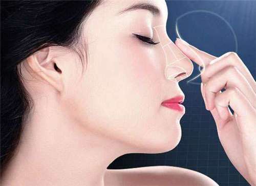 戴传昌的鼻子有多厉害？术后鼻子堪比打印机效果，附技术分析插图1