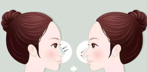 陈涛医生口碑怎么样？鼻部整形医生推荐 | 郑州铭艺插图3