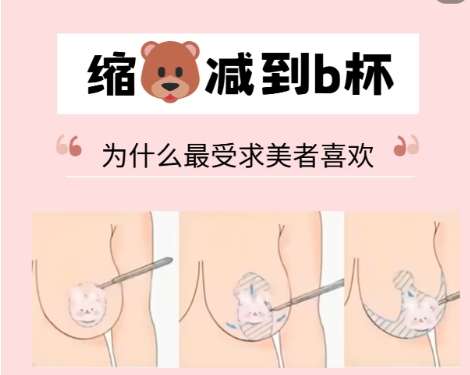 王希润医生口碑怎么样？胸部整形医生推荐 | 青岛大学附属妇女儿童医院插图2