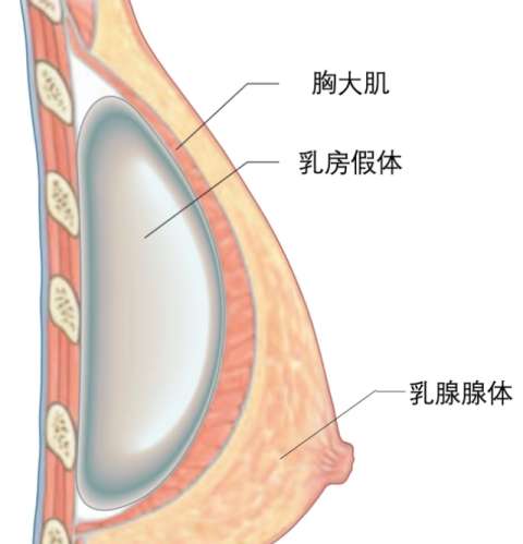宋维江医生口碑怎么样？胸部整形医生推荐 | 艾悦容插图1