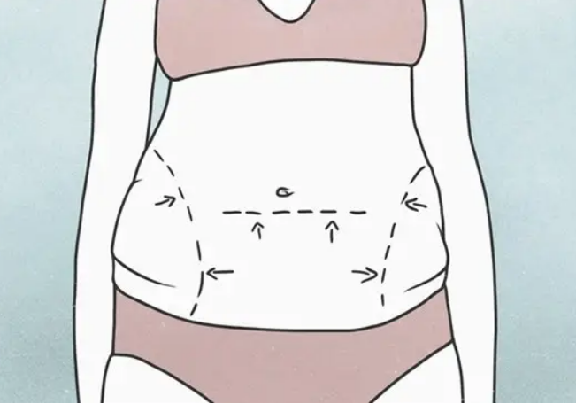 淮安仁爱腰腹吸脂后可运动吗?插图 淮安仁爱腰腹吸脂后可运动吗?插图