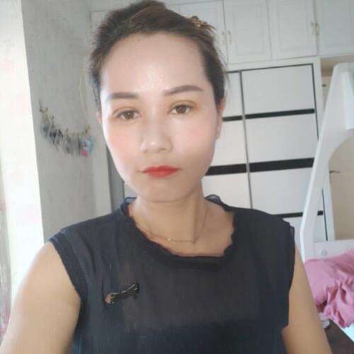 游晓波双眼皮案例分析插图1 游晓波双眼皮案例分析插图1