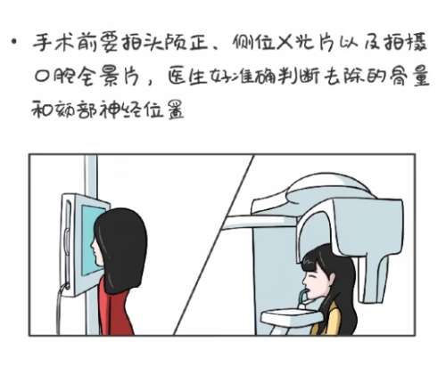 南京颌面外科医生排名!医生口碑介绍|案例鉴赏!插图4 南京颌面外科医生排名!医生口碑介绍|案例鉴赏!插图4