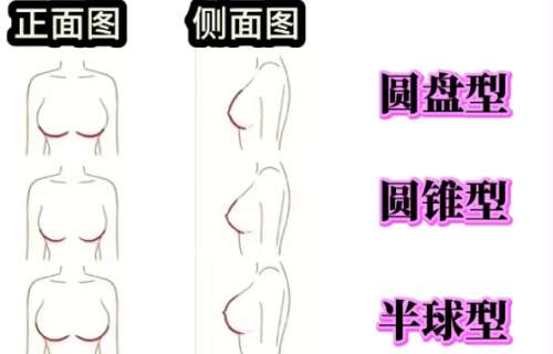 长沙脂肪隆胸哪个医生好?五位医生详细介绍插图4 长沙脂肪隆胸哪个医生好?五位医生详细介绍插图4