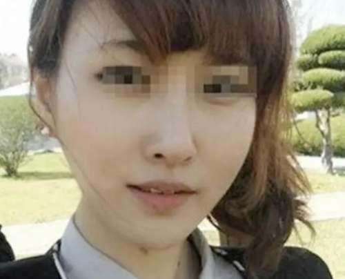 黄大勇颧骨内推案例分析插图3