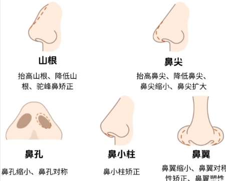 王永功医生隆鼻怎么样?多少钱?价格附上!插图4 王永功医生隆鼻怎么样?多少钱?价格附上!插图4