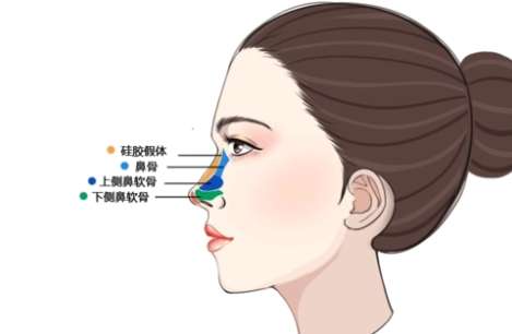西安画美做鼻子医生哪位技术靠谱?李小正、张沙沙如何选择?插图4 西安画美做鼻子医生哪位技术靠谱?李小正、张沙沙如何选择?插图4