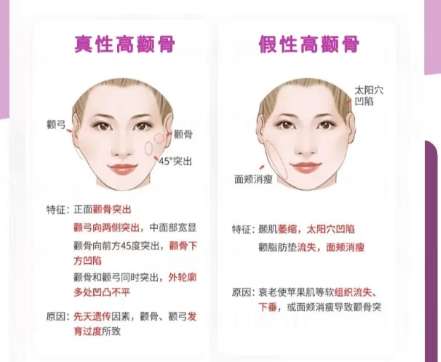 项昌峰医生好么?医生口碑测评|擅长项目介绍!插图4 项昌峰医生好么?医生口碑测评|擅长项目介绍!插图4