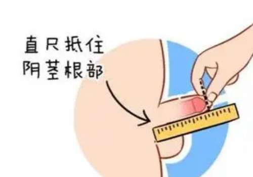 重庆李世荣个人资料简介，男性私密整形经验丰富，重点分享插图2