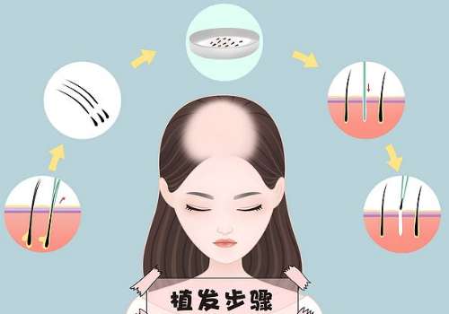 胡志奇医生厉害的三个项目是什么?医生信息、核心项目分析!插图3 胡志奇医生厉害的三个项目是什么?医生信息、核心项目分析!插图3