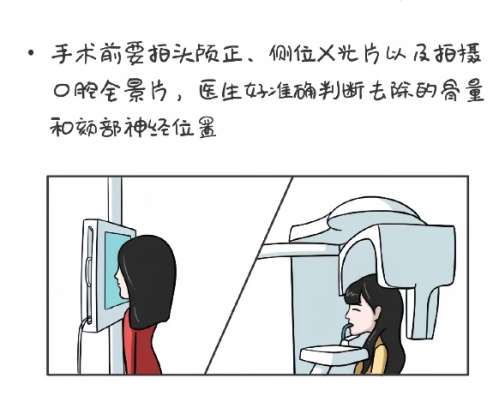 西安磨骨医生排名!医生口碑评价|案例鉴赏!插图4 西安磨骨医生排名!医生口碑评价|案例鉴赏!插图4
