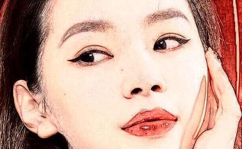 山东省立医院毕见海厚唇整形案例分析插图2 山东省立医院毕见海厚唇整形案例分析插图2