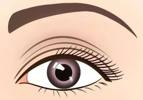 成都唐军双眼皮修复口碑怎么样?线条流畅，整体来看自然美观插图1