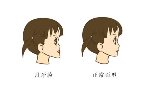 重庆颏成型医生肖林与刘正茂哪个水平高?各有千秋,来看详情分享插图 重庆颏成型医生肖林与刘正茂哪个水平高?各有千秋,来看详情分享插图
