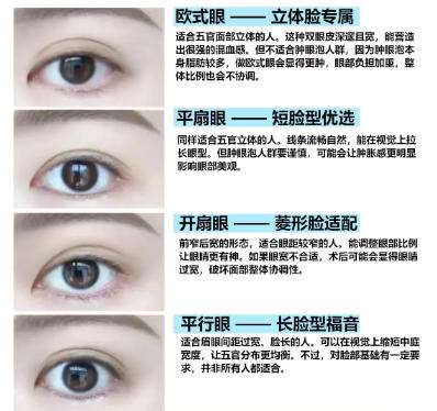 杨忠医生双眼皮技术怎么样?医生实力点评|案例图展示!插图4 杨忠医生双眼皮技术怎么样?医生实力点评|案例图展示!插图4