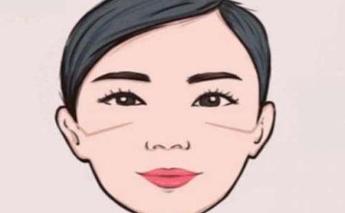 北京大学肿瘤医院马骁颧骨内推技术优势怎么样?案例评价插图1 北京大学肿瘤医院马骁颧骨内推技术优势怎么样?案例评价插图1