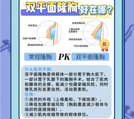 广州隆胸医生前十名！医生名单揭秘详细详细介绍插图4