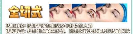石家庄双眼皮医生排名!赵亚平|苏晓光|王晓等医生都在榜上!插图4 石家庄双眼皮医生排名!赵亚平|苏晓光|王晓等医生都在榜上!插图4