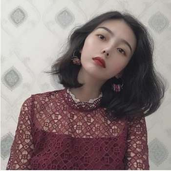 黄金龙医生双眼皮案例,术后和小眼睛差别很大,真的是水汪汪!插图5 黄金龙医生双眼皮案例,术后和小眼睛差别很大,真的是水汪汪!插图5