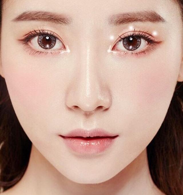 做完双眼皮手术后要注意哪些事项?插图 做完双眼皮手术后要注意哪些事项?插图