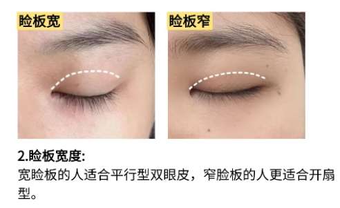 大连双眼皮医生推荐!医生擅长项目介绍插图4 大连双眼皮医生推荐!医生擅长项目介绍插图4