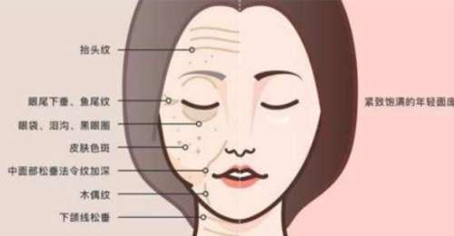 冯立哲面部提升怎么样?面部提升案例分析插图1 冯立哲面部提升怎么样?面部提升案例分析插图1