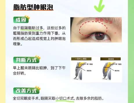 绍兴双眼皮医生蒋燕怎么样?最新医生个人资料信息!插图4 绍兴双眼皮医生蒋燕怎么样?最新医生个人资料信息!插图4