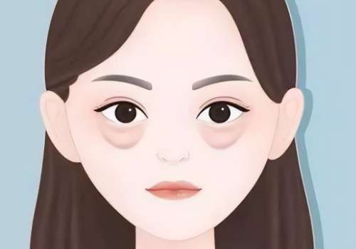 广州李娟祛眼袋好吗？技术沉稳、审美在线！附价格明细插图1