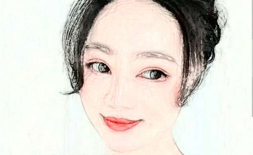 南华大学附属第一医院祝子雯光子嫩肤技术风格怎么样?术后120天案例插图1