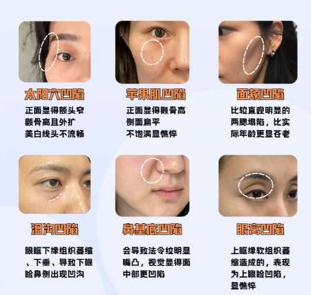 时光谭琳琳医生怎么样?医生基本资料及擅长项目介绍!插图4 时光谭琳琳医生怎么样?医生基本资料及擅长项目介绍!插图4