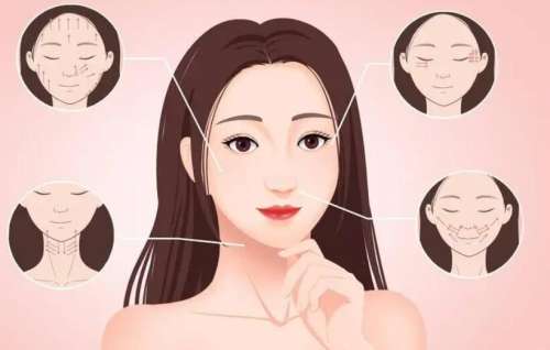 汤张洪医生做拉皮好吗?技术如何?顾客真实经历附上!插图2 汤张洪医生做拉皮好吗?技术如何?顾客真实经历附上!插图2