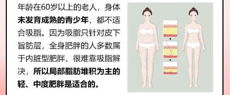 重庆做吸脂比较好的医生具体情况!医生技术过硬审美好!插图4 重庆做吸脂比较好的医生具体情况!医生技术过硬审美好!插图4