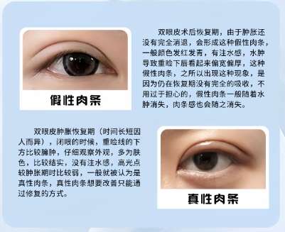 孙大山医生个人简介分享!做双眼皮技术如何?插图4 孙大山医生个人简介分享!做双眼皮技术如何?插图4