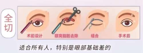 沈阳双眼皮医生排名有哪些？了解技术和实力均在线的专业医生！插图4