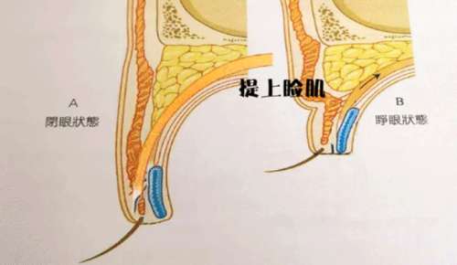 成浩医生做双眼皮怎么样?这位高人气医生信息详情快快收藏!插图2 成浩医生做双眼皮怎么样?这位高人气医生信息详情快快收藏!插图2