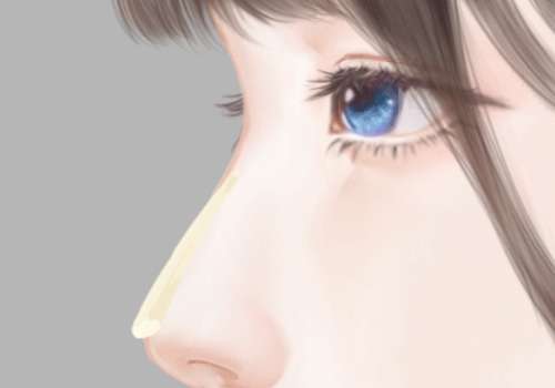 尤建军医生隆鼻怎么样?23年临床经验、掌握多种鼻型、崇尚自然风插图4 尤建军医生隆鼻怎么样?23年临床经验、掌握多种鼻型、崇尚自然风插图4