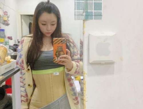 陈叶林吸脂案例分析插图2 陈叶林吸脂案例分析插图2