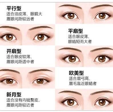 双眼皮有几种款式？那种最流行？插图
