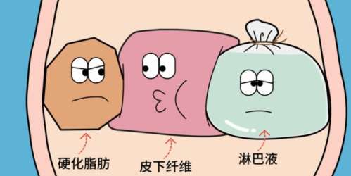 闫爱跃抽脂怎么样？实操做吸脂手术要花多少钱？坐诊医院公布插图2
