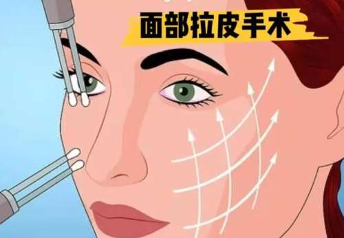 福州周秀峰拉皮技术好吗？医生如何预约？拉皮手术前后对比图曝光插图2