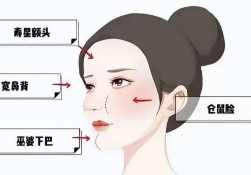 郑州丽天整形馒化修复怎么样?专业解析与医生推荐!插图3 郑州丽天整形馒化修复怎么样?专业解析与医生推荐!插图3