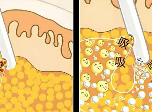 张井忠怎么样?大连美天医院人气医生信息盘点!插图2 张井忠怎么样?大连美天医院人气医生信息盘点!插图2